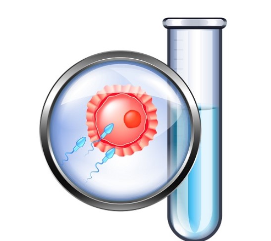 danh sách câu hỏi thường gặp trước khi làm IVF