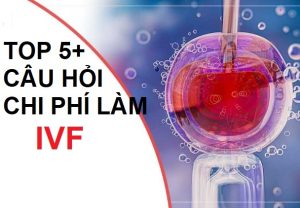 Các câu hỏi thường gặp về chi phí làm IVF hết bao nhiêu?