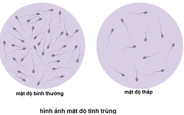 Ít tinh trùng trong tinh dịch