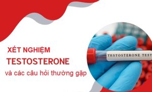 xét nghiệm testosterone là gì
