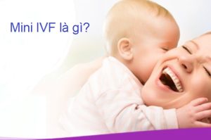 mini ivf là gì